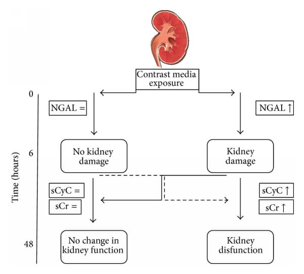CysC與NGAL、Cr的關(guān)系 CysC與NGAL、Cr的關(guān)系